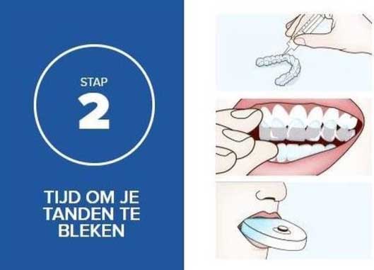 thuis tanden bleken