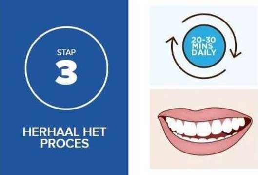 thuis tanden bleken met bleekgel